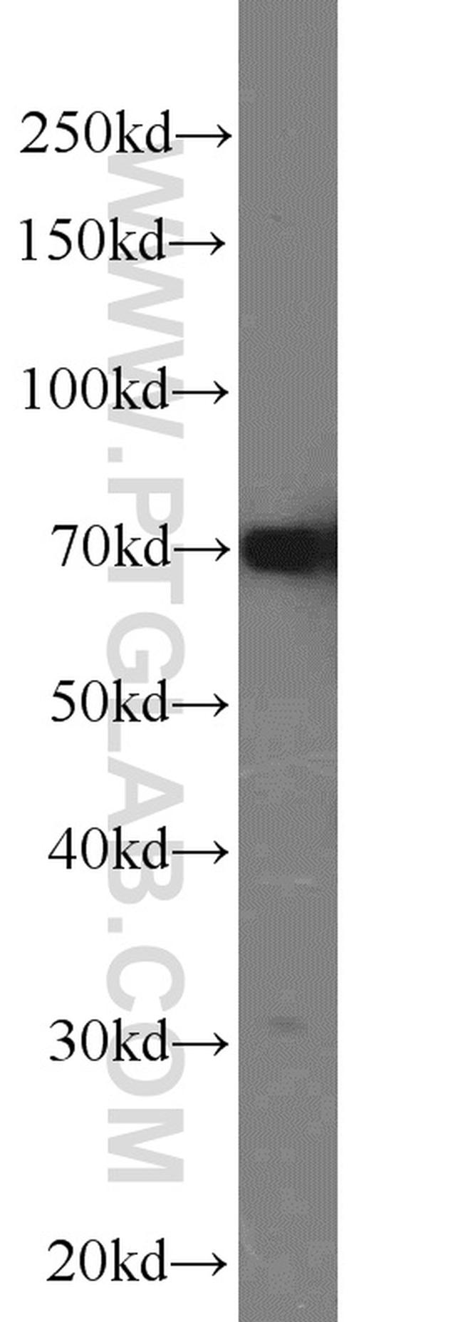 HADHA Antibody in Western Blot (WB)