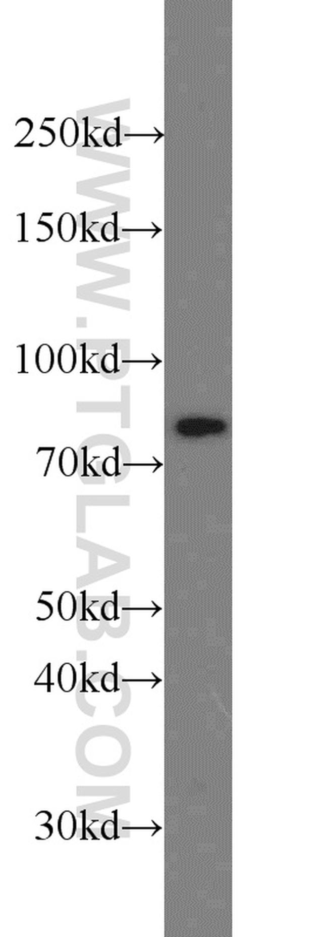 HADHA Antibody in Western Blot (WB)