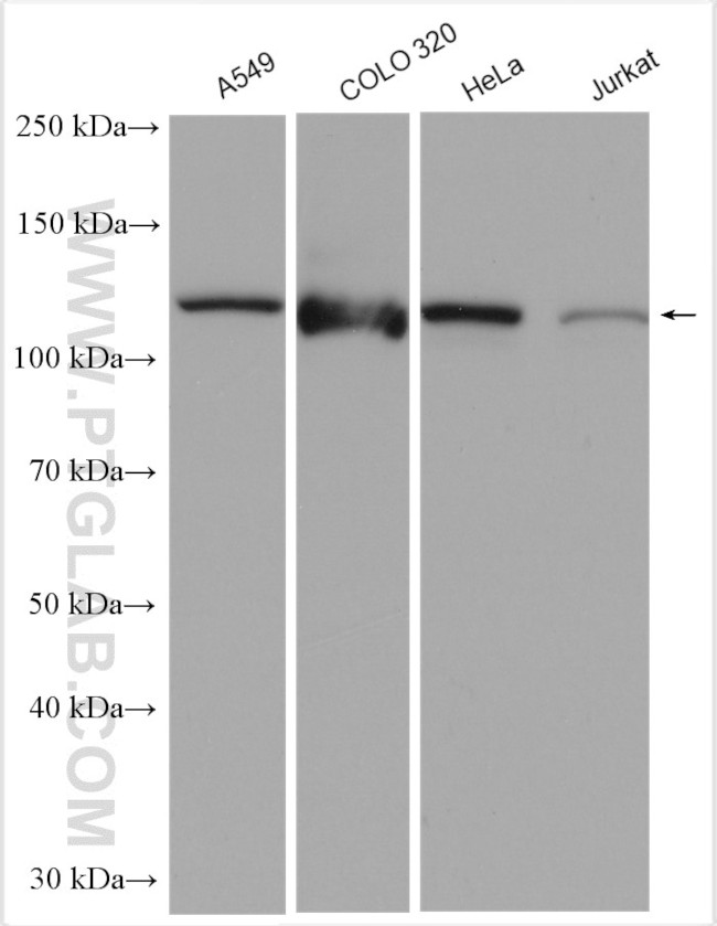 SND1 Antibody in Western Blot (WB)