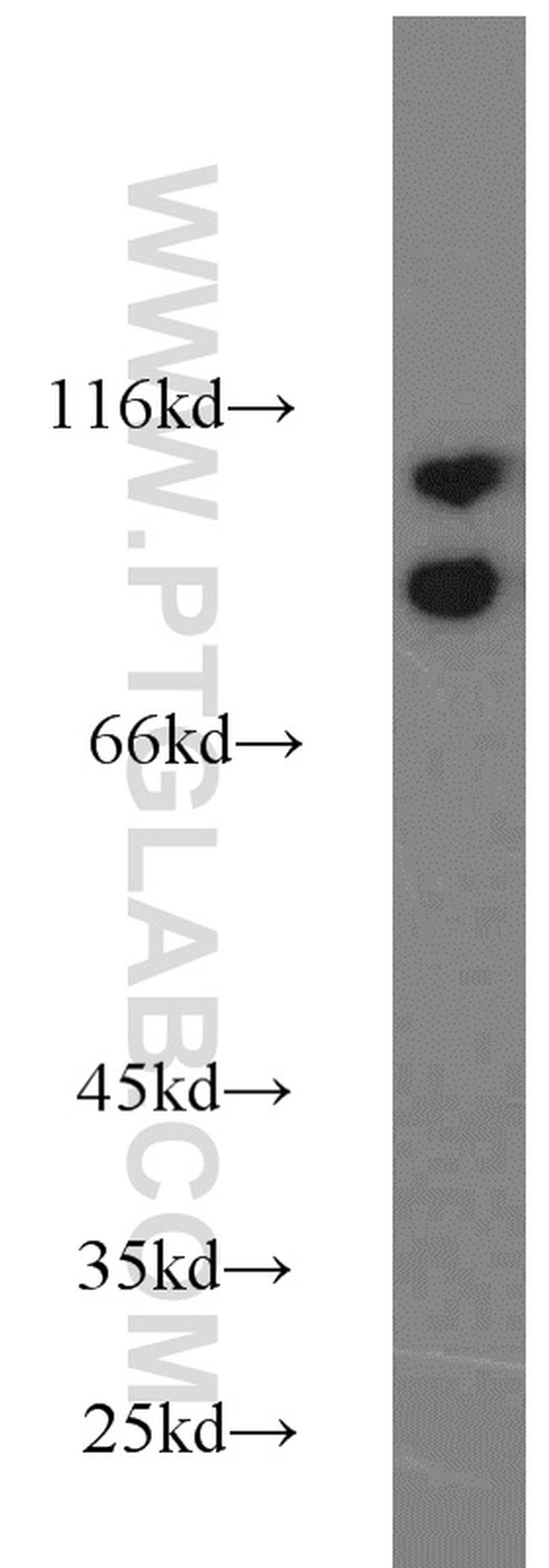 SND1 Antibody in Western Blot (WB)