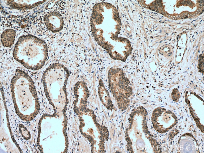 CDK1 Antibody in Immunohistochemistry (Paraffin) (IHC (P))