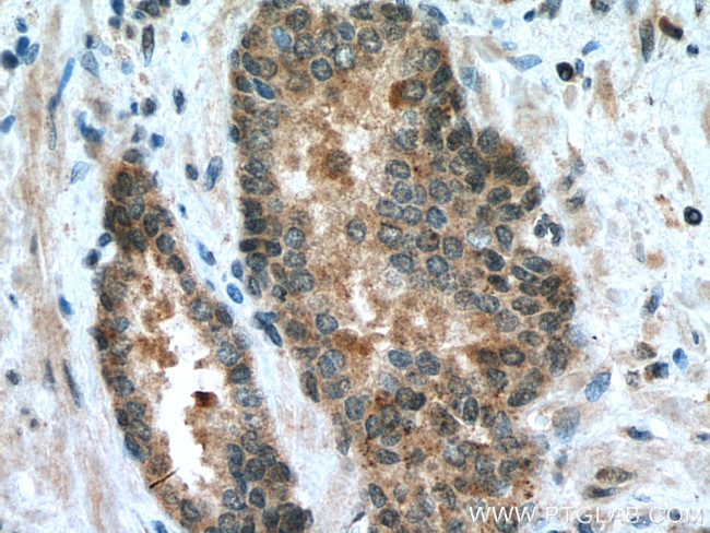 CDK1 Antibody in Immunohistochemistry (Paraffin) (IHC (P))