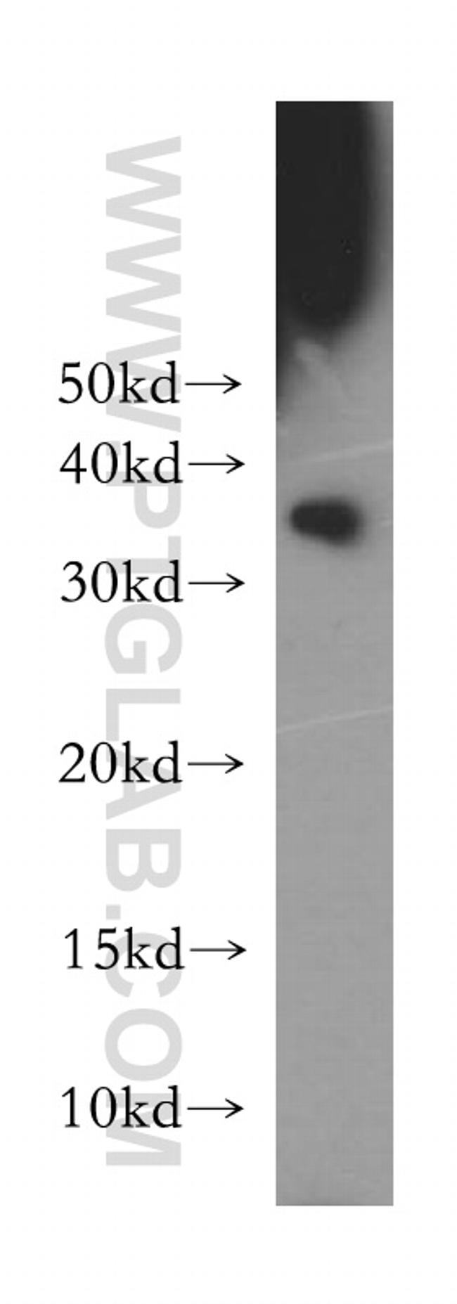 CDK1 Antibody in Western Blot (WB)