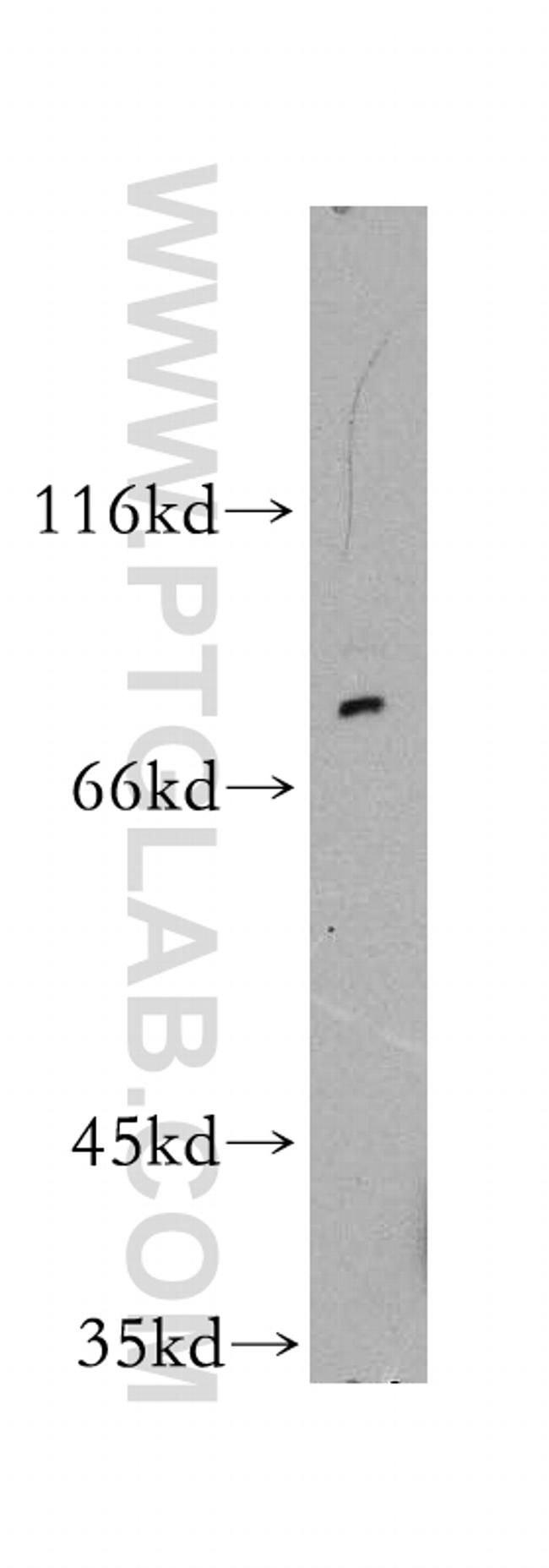 GSPT1 Antibody in Western Blot (WB)