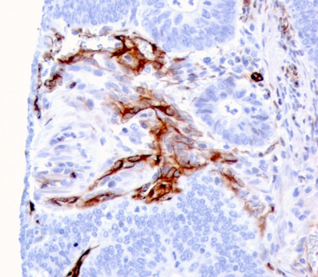 Nestin Antibody in Immunohistochemistry (Paraffin) (IHC (P))