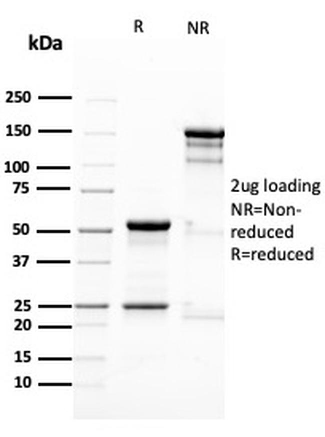 Nestin Antibody in SDS-PAGE (SDS-PAGE)