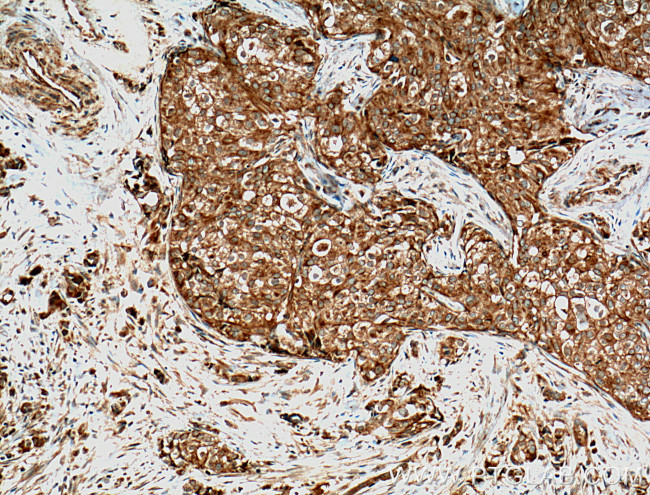 GTPBP3 Antibody in Immunohistochemistry (Paraffin) (IHC (P))