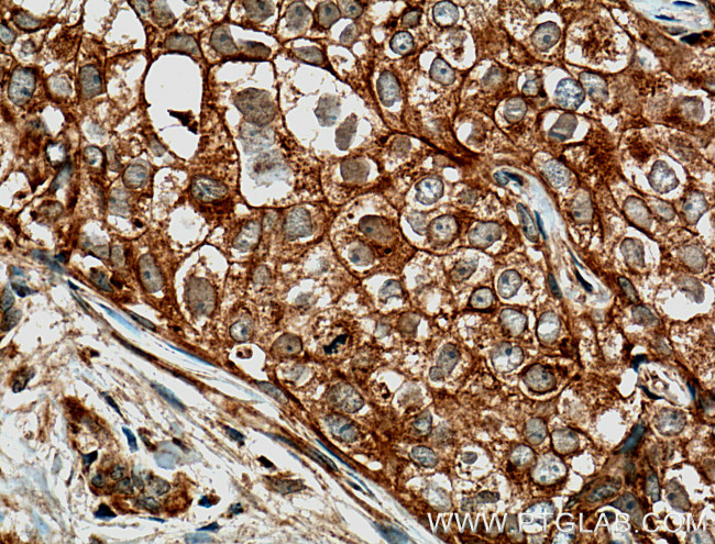 GTPBP3 Antibody in Immunohistochemistry (Paraffin) (IHC (P))