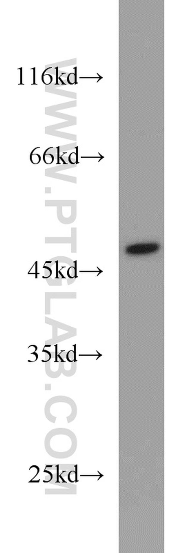 GTPBP3 Antibody in Western Blot (WB)