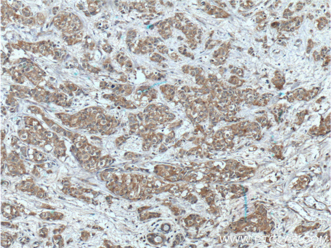 PRG2 Antibody in Immunohistochemistry (Paraffin) (IHC (P))