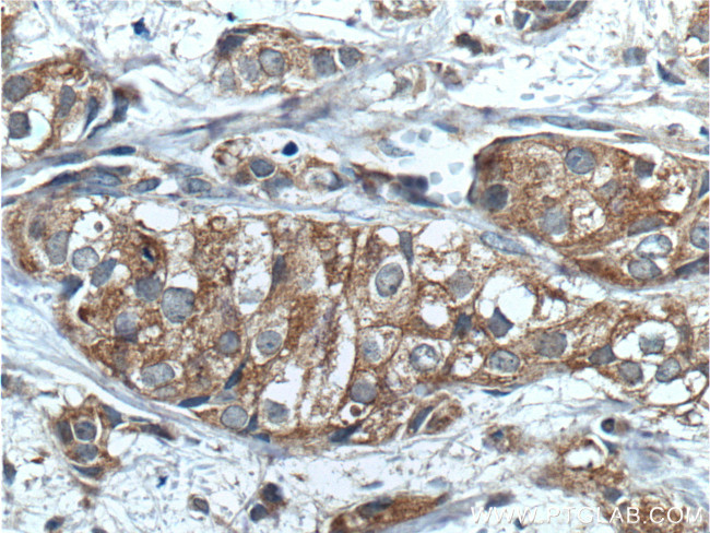 PRG2 Antibody in Immunohistochemistry (Paraffin) (IHC (P))