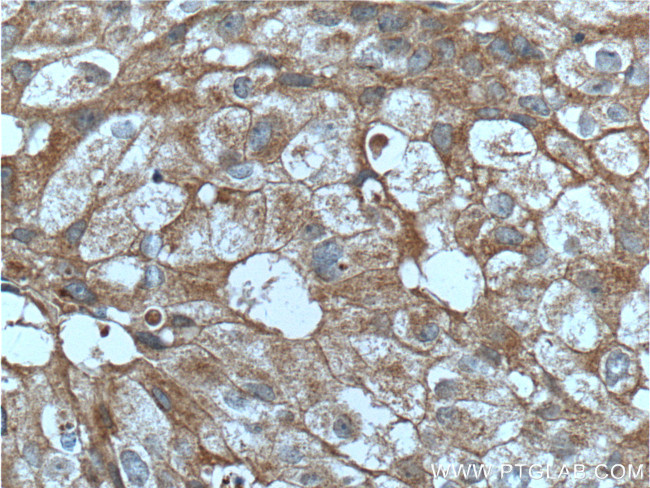 PRG2 Antibody in Immunohistochemistry (Paraffin) (IHC (P))