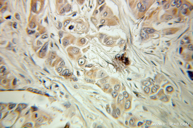 COG1 Antibody in Immunohistochemistry (Paraffin) (IHC (P))