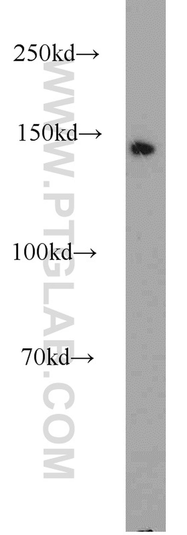 COG1 Antibody in Western Blot (WB)