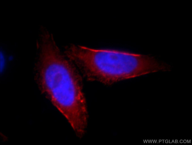 SEPT9 Antibody in Immunocytochemistry (ICC/IF)