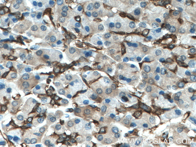 SEPT9 Antibody in Immunohistochemistry (Paraffin) (IHC (P))