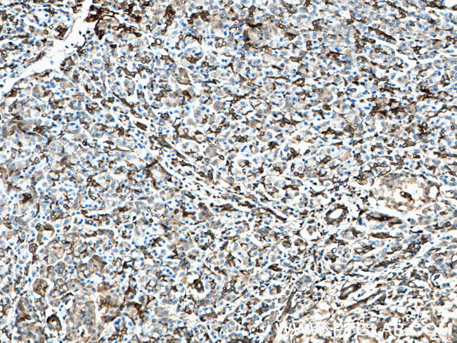 SEPT9 Antibody in Immunohistochemistry (Paraffin) (IHC (P))