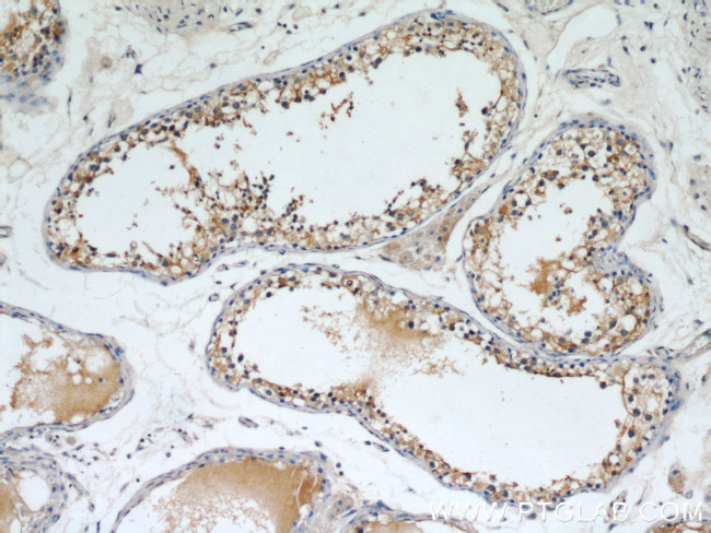 SEPT9 Antibody in Immunohistochemistry (Paraffin) (IHC (P))