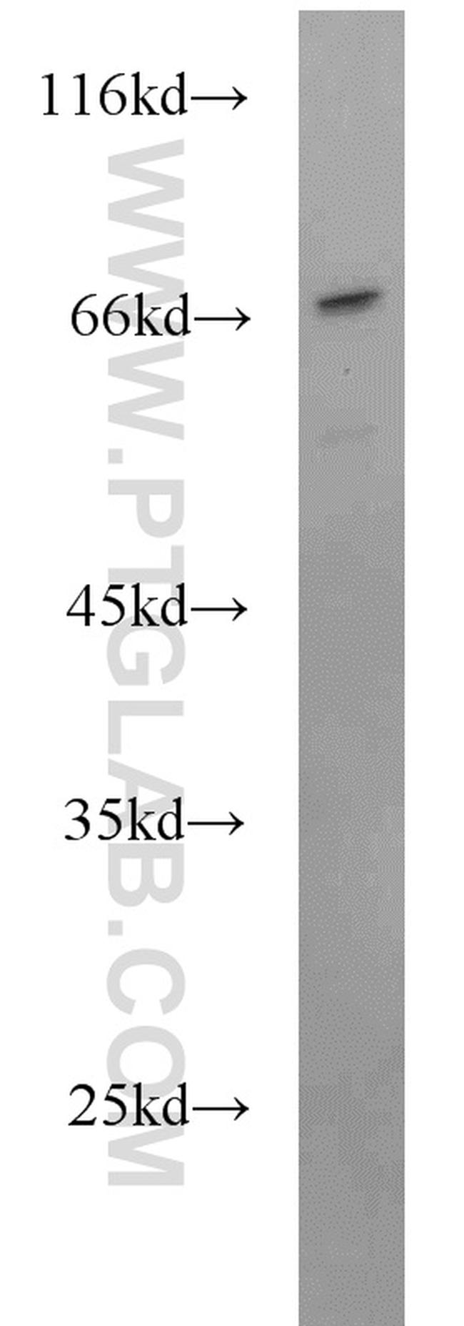 SEPT9 Antibody in Western Blot (WB)