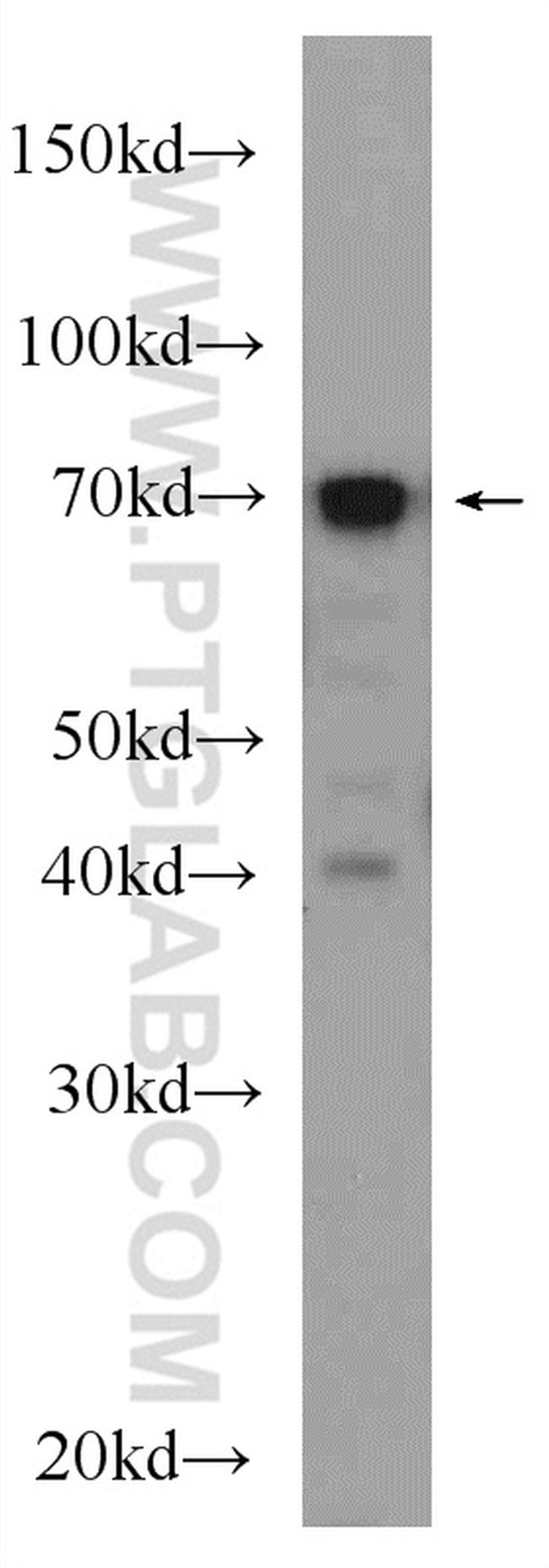 SEPT9 Antibody in Western Blot (WB)