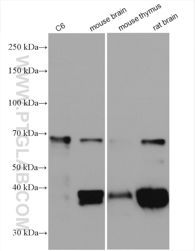 SEPT9 Antibody in Western Blot (WB)