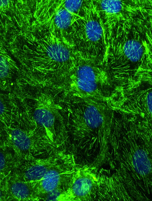 SEPT9 Antibody in Immunocytochemistry (ICC/IF)