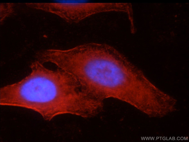 SEPT9 Antibody in Immunocytochemistry (ICC/IF)