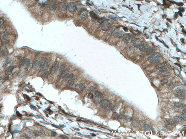 SEPT9 Antibody in Immunohistochemistry (Paraffin) (IHC (P))