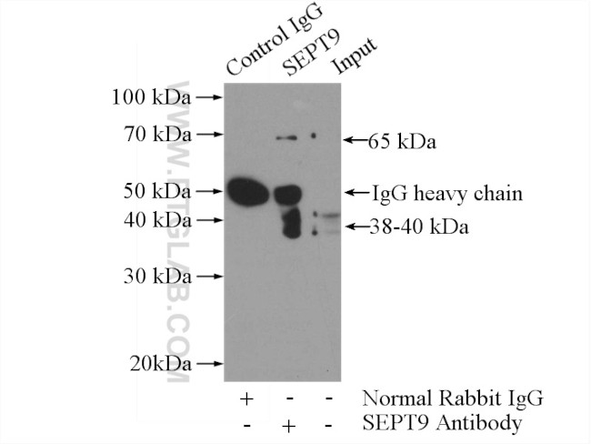 SEPT9 Antibody in Immunoprecipitation (IP)