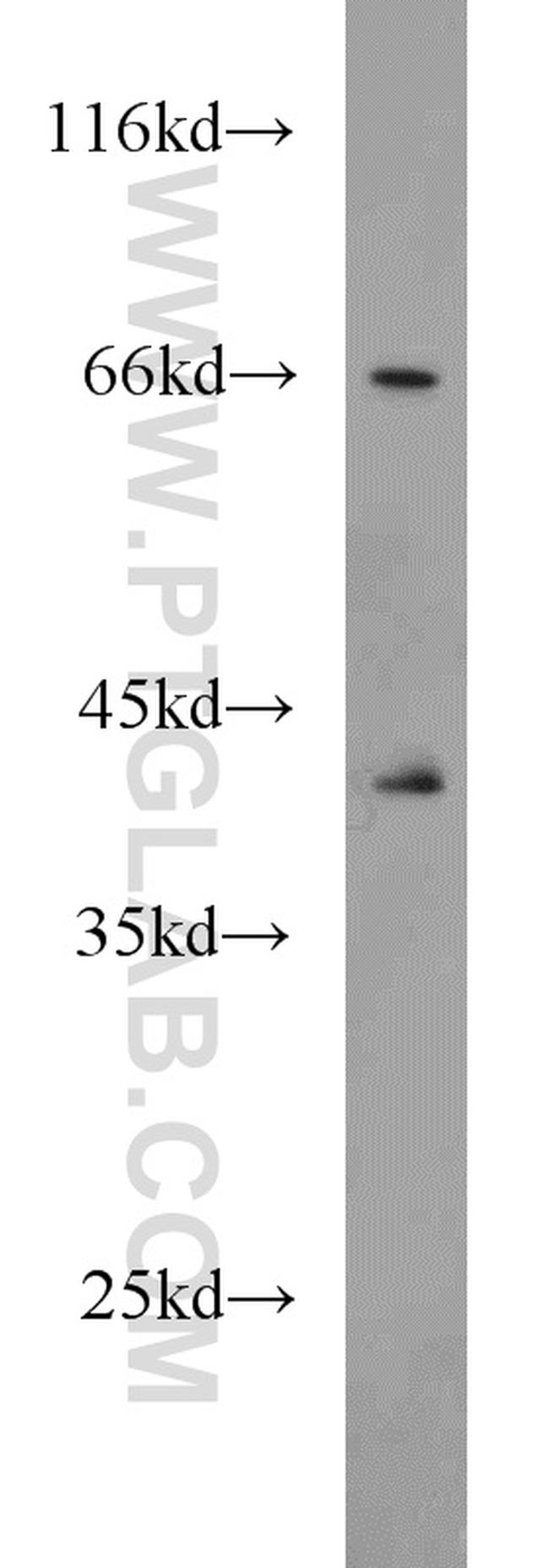 SEPT9 Antibody in Western Blot (WB)