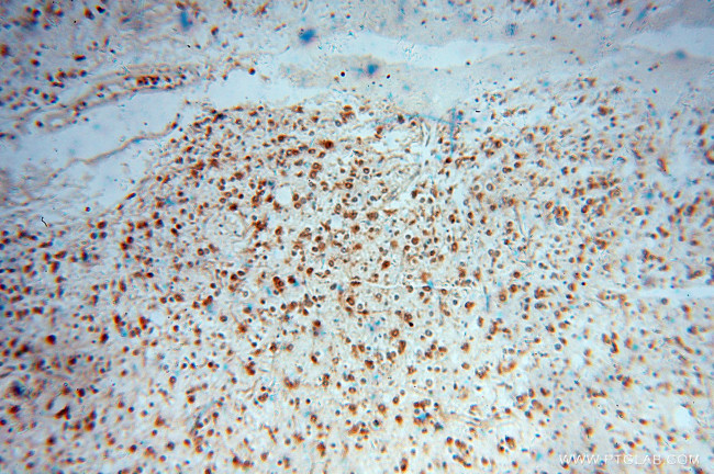 MSI2 Antibody in Immunohistochemistry (Paraffin) (IHC (P))