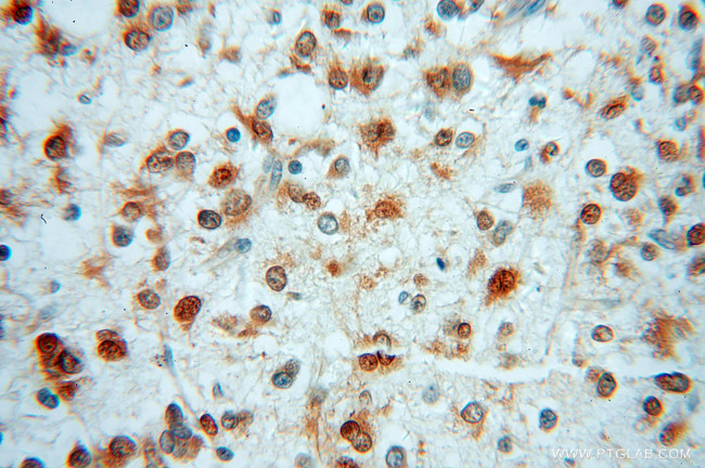 MSI2 Antibody in Immunohistochemistry (Paraffin) (IHC (P))