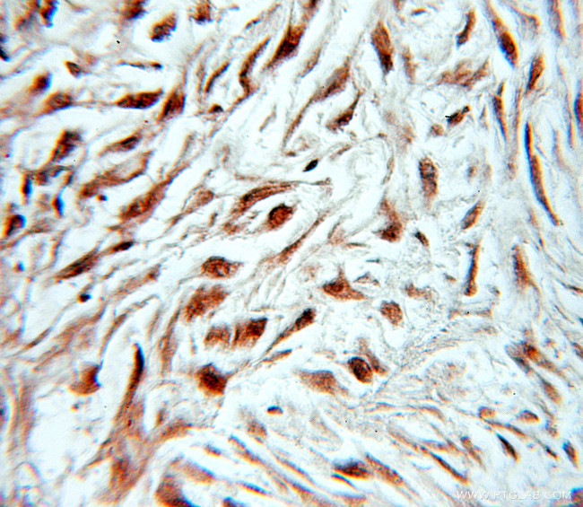 MSI2 Antibody in Immunohistochemistry (Paraffin) (IHC (P))