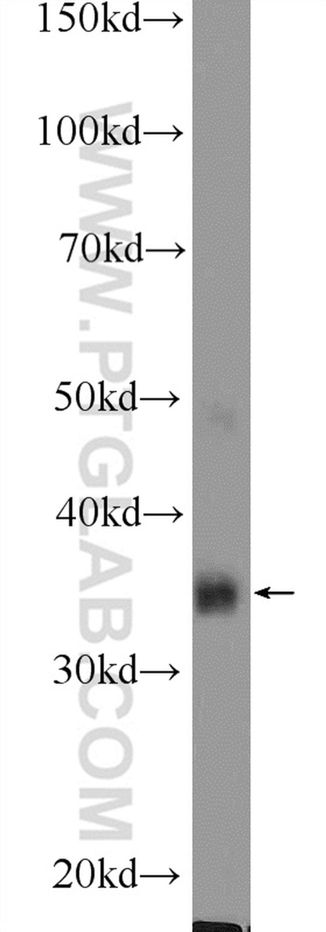 MSI2 Antibody in Western Blot (WB)