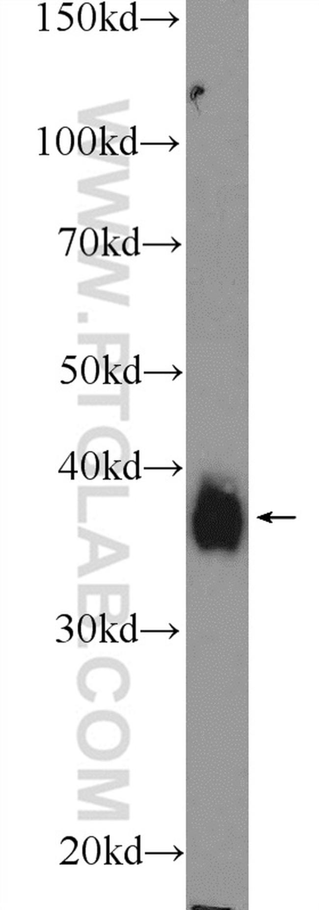 MSI2 Antibody in Western Blot (WB)