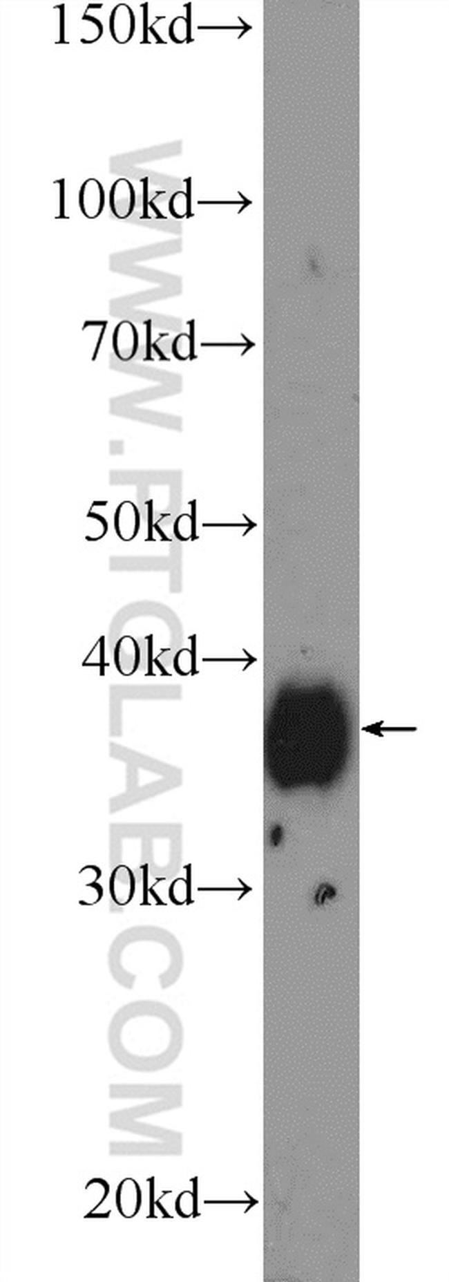 MSI2 Antibody in Western Blot (WB)