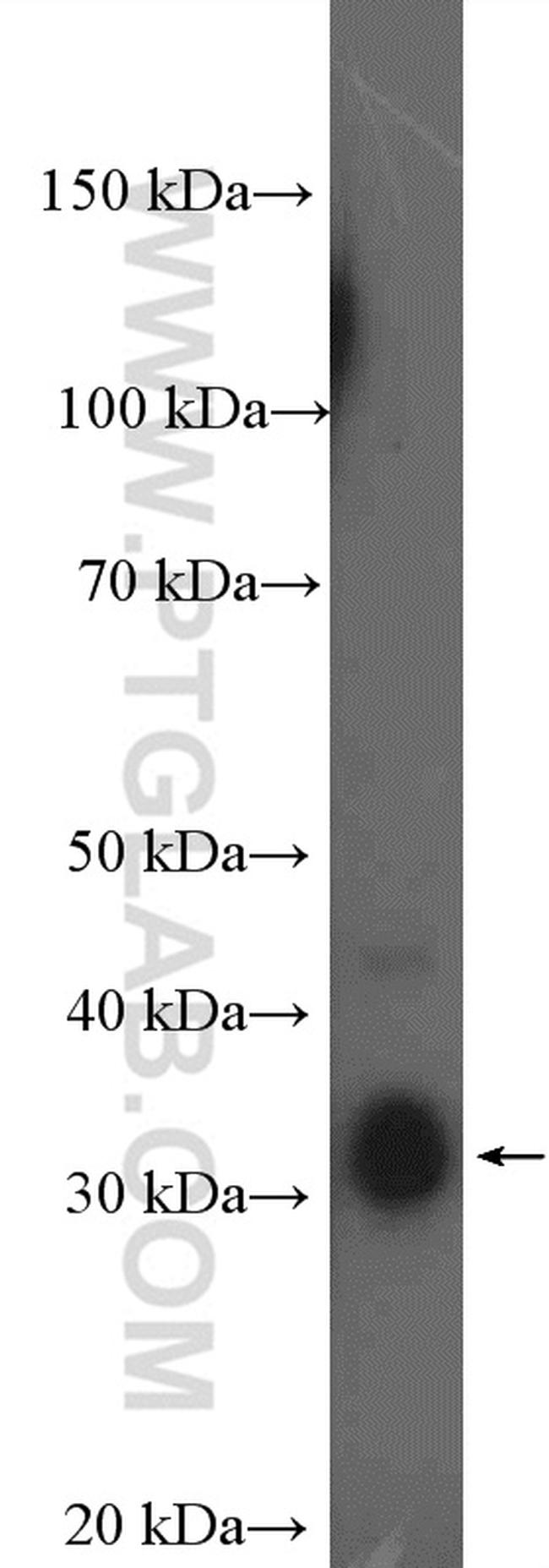 MSI2 Antibody in Western Blot (WB)