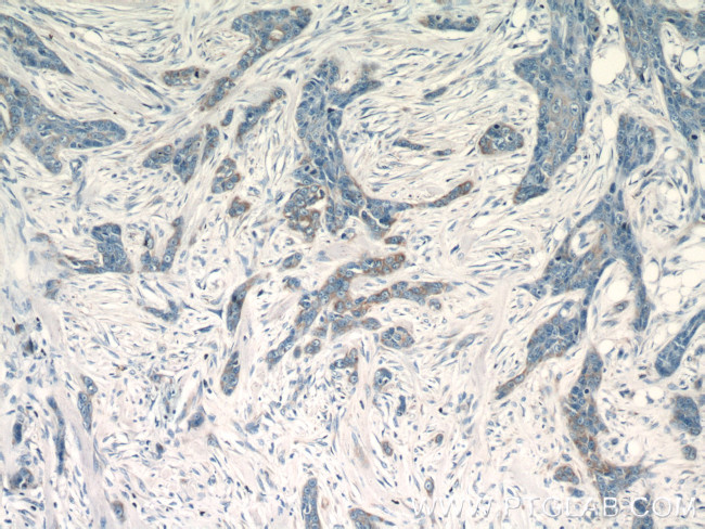 PACT Antibody in Immunohistochemistry (Paraffin) (IHC (P))