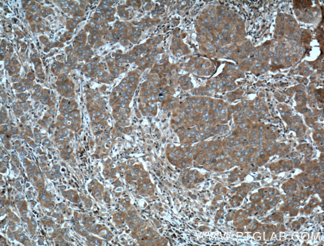 PACT Antibody in Immunohistochemistry (Paraffin) (IHC (P))