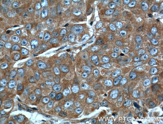 PACT Antibody in Immunohistochemistry (Paraffin) (IHC (P))