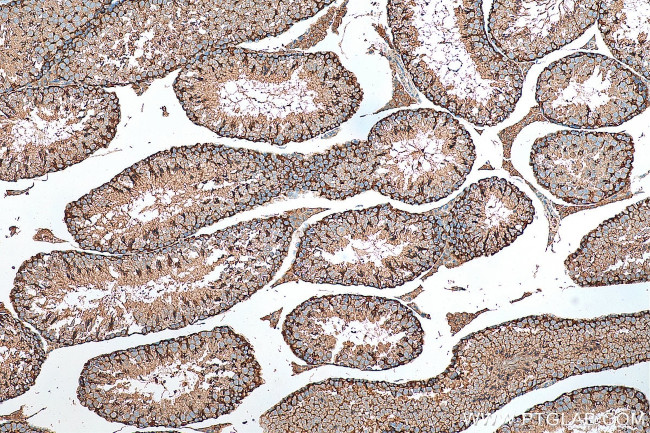 PACT Antibody in Immunohistochemistry (Paraffin) (IHC (P))