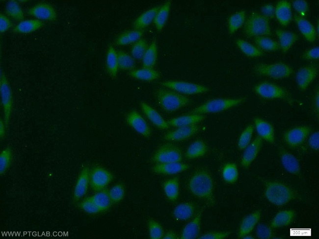 SNX3 Antibody in Immunocytochemistry (ICC/IF)