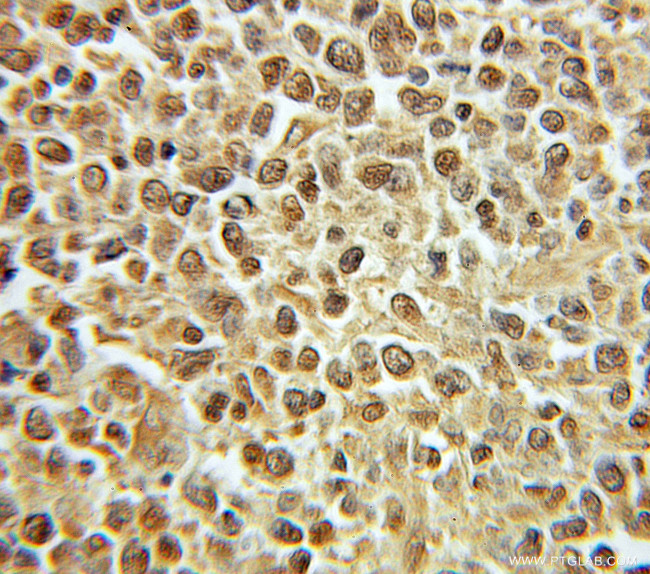 PRIM1 Antibody in Immunohistochemistry (Paraffin) (IHC (P))