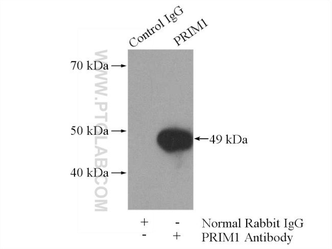 PRIM1 Antibody in Immunoprecipitation (IP)