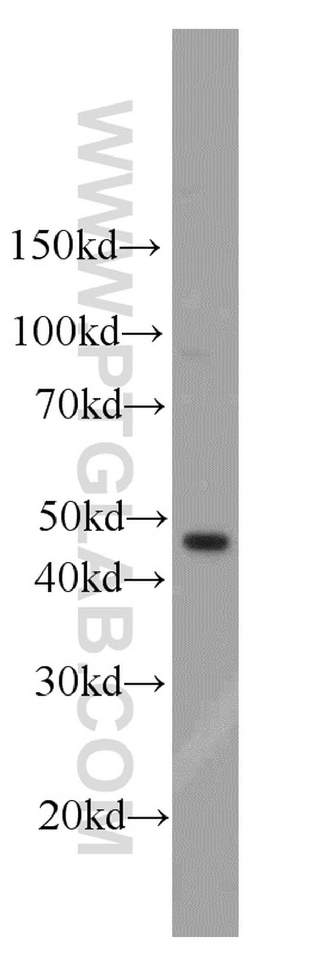 PRIM1 Antibody in Western Blot (WB)