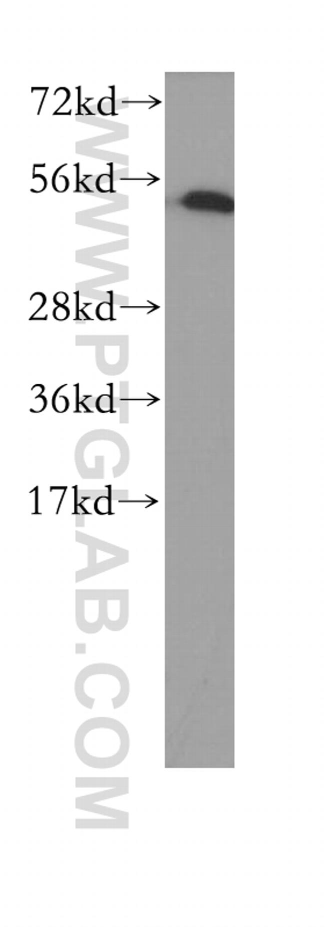 PRIM1 Antibody in Western Blot (WB)