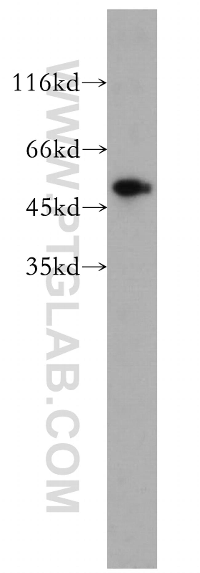 PRIM1 Antibody in Western Blot (WB)