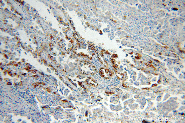 SFTPC Antibody in Immunohistochemistry (Paraffin) (IHC (P))