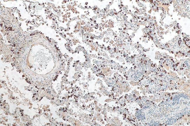 SFTPC Antibody in Immunohistochemistry (Paraffin) (IHC (P))