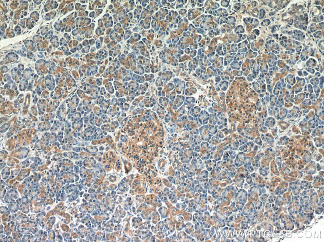 BLVRA Antibody in Immunohistochemistry (Paraffin) (IHC (P))